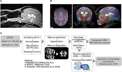 Reduced cingulate gyrus volume in Cavalier King Charles Spaniels with syringomyelia and neuropathic pain revealed by voxel-based morphometry: a pilot study